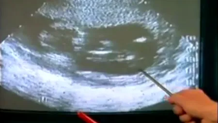 Un licean din Vaslui a leșinat în timp ce profesorul de religie prezenta un film despre avort. „Nu e film de groază, l-am prezentat ca să perceapă păcatul avortului