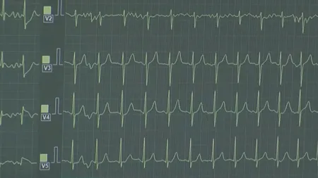 Cum ar putea fi ajutați cardiacii sau hipertensivii, cu ajutorul Inteligenței Artificiale. Este următorul pas în medicina modernă
