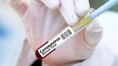 COVID-19. Numărul cazurilor noi a scăzut sub 2.000, săptămâna trecută, prima dată după aproape o lună și jumătate. A crescut numărul cadrelor medicale infectate