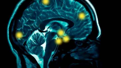 Cercetătorii explică, în premieră, modul în care ciupercile magice ne modifică creierul