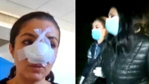 GÂNDUL LIVE. Femeia care a desfigurat-o pe Cristina Joia, reținută 24 de ore, după cinci ore de audieri. Oamenii legii așteaptă, acum, raportul IML