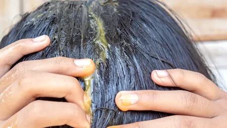 Îți cade părul? Tratamentul de 1 leu împotriva căderii părului