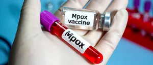 Alertă de MPOX în Marea Britanie: apar tot mai multe cazuri cu tulpina Clade 1b!