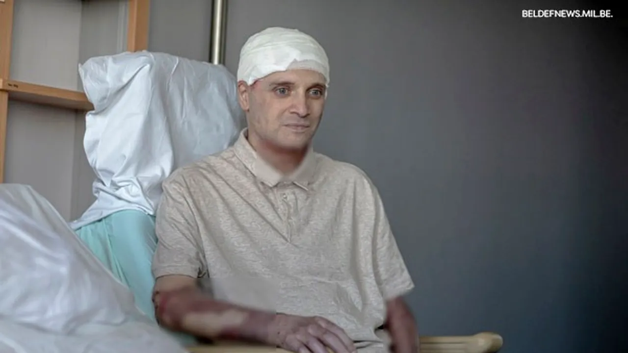 Primele imagini cu medicul Cătălin Denciu, transferat în Belgia după incendiul de la Piatra Neamț: „Recuperarea este departe de a se termina, dar știu că trebuie să dau totul” - FOTO