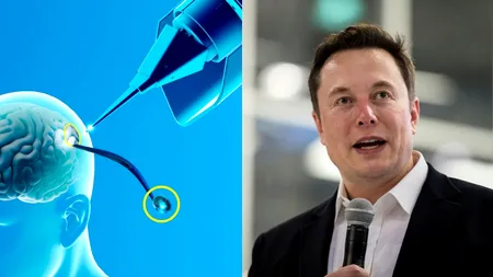 O femeie, paralizată complet, a reușit să-și SCRIE numele cu ajutorul tehnologiei Neuralink. Elon Musk: 