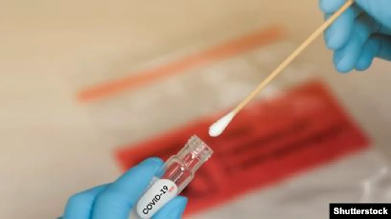 Numărul cazurilor de îmbolnăvire cu coronavirus rămâne ridicat. În ultimele 24 de ore, au fost înregistrate alte 413 noi cazuri de îmbolnăvire din 6.655 de teste efectuate/ La nivel național, au fost prelucrate 854.241 de teste