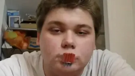 Gest de Anul Nou: Și-a băgat pocnitorile în gură. VIDEO