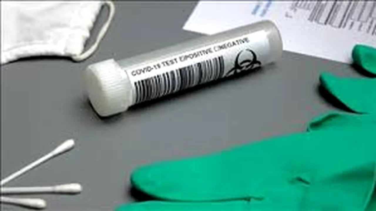 Rusia afirmă că în Orientul Mijlociu au început studiile vaccinului său împotriva coronavirusului