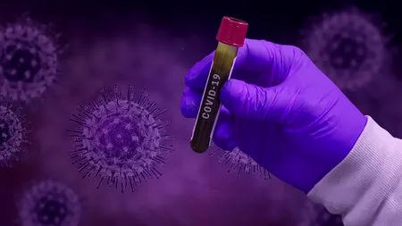 PARADOX. Cazurile de Covid-19 în România: mai multe femei infectate, dar mai mulți bărbați decedați!