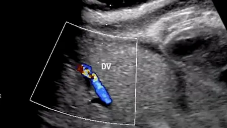 A fost inventat „uterul artificial