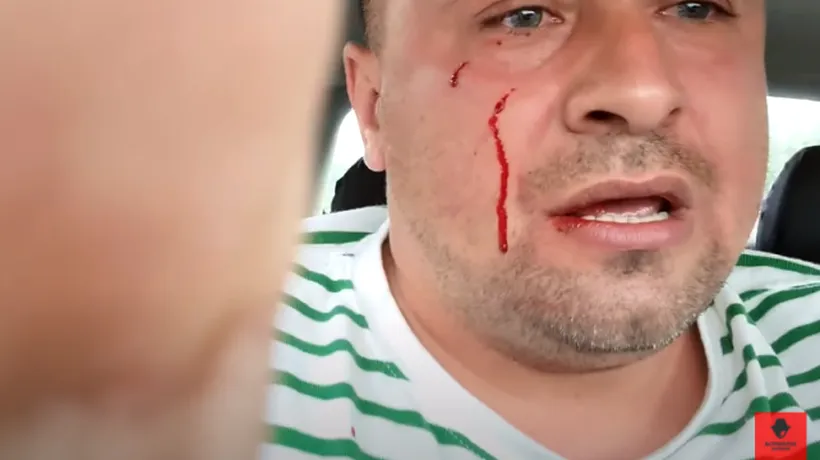 VIDEO| Activist din Buzău, bătut de față cu doi polițiști: „Dădeau cu pumnii, cu pietrele. Poliția nu mă proteja cu nimic”