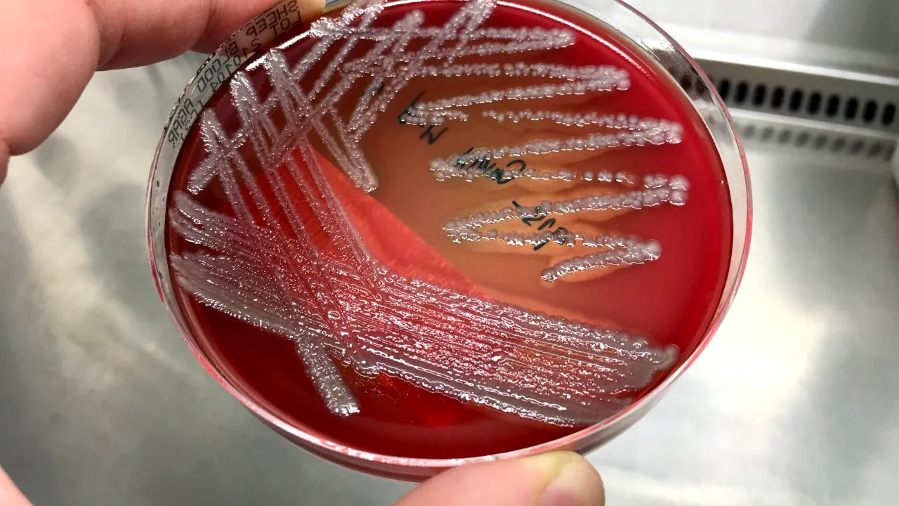 Cercetătorii au descoperit o bacterie care îmbolnăvește peștii din Marea Neagră