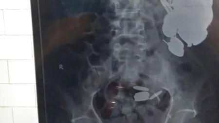 A mers la spital acuzând „dureri inimaginabile