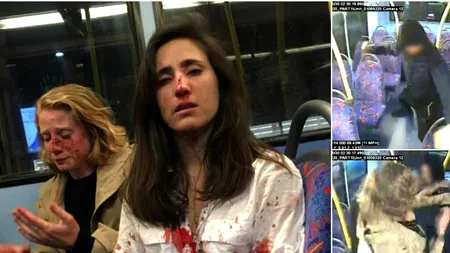 Bătute cu bestialitate pentru că au refuzat avansurile a trei adolescenți într-un autobuz: Ne-au pus să ne sărutăm. Apoi ne-au lăsat într-o baltă de sânge