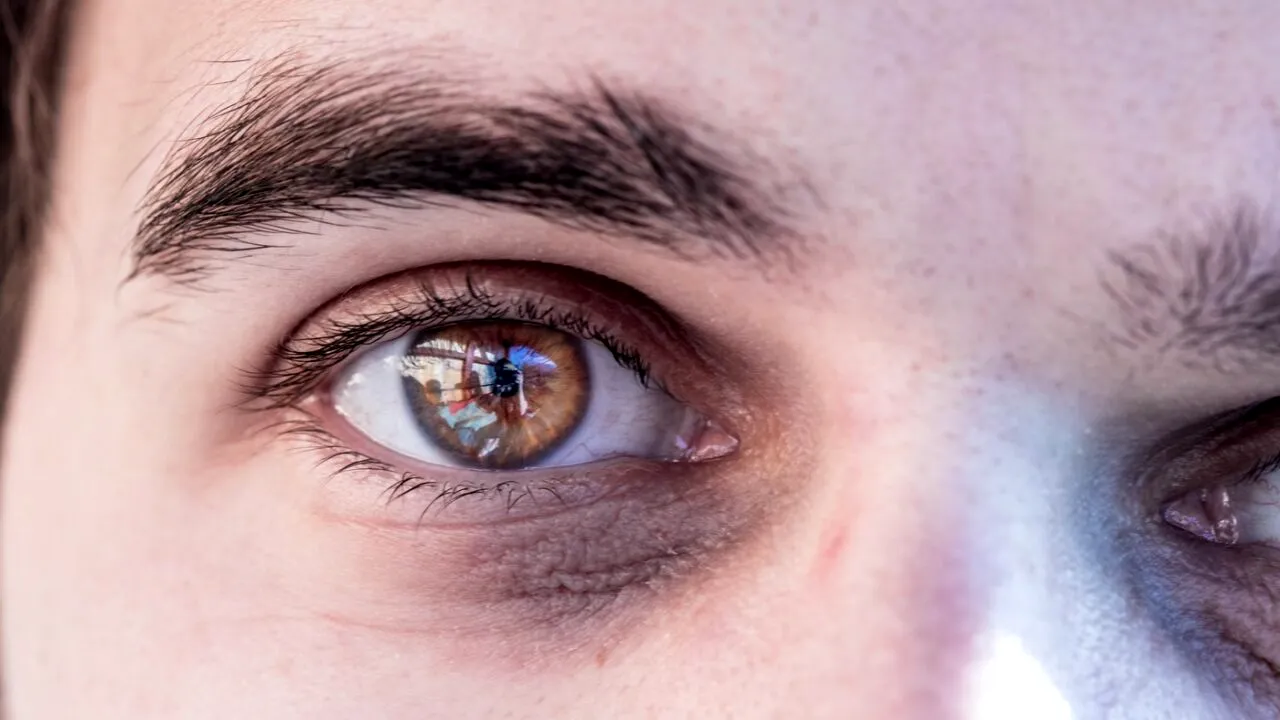 Ce înseamnă atunci când ți se zbate OCHIUL, în funcție de oră. Explicațiile medicale ale fenomenului vs. interpretarea populară