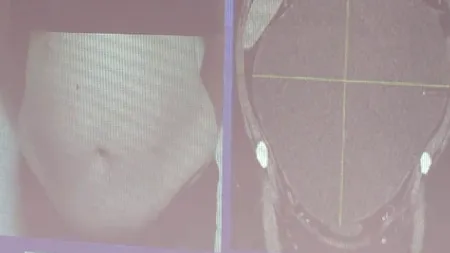 Surpriza unei femei din Constanța care a crezut că este gravidă