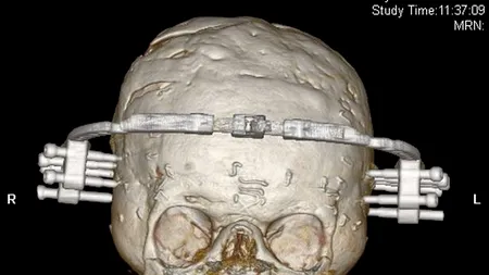Când s-a născut medicii nu i-au dat nicio șansă la viață. Acum a fost declarat 