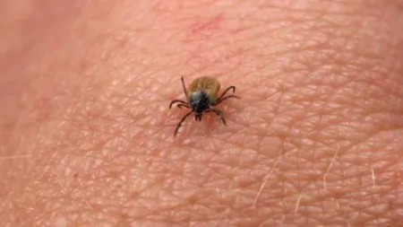 Medicul Virgil Musta, despre riscurile de infectare cu boala Lyme în cazul unei mușcături de căpușă: Organismul are mecanisme de a o limita