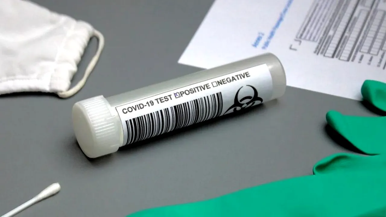 Cum justifică autoritățile că avem aproape o mie de cazuri noi COVID-19 şi la 6 mii de teste, dar şi la 22 de mii?! (EXCLUSIV)