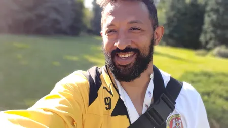 Kamara s-a lăsat pe mâna medicului ESTETICIAN. ”Nu mai puteam să stau așa”