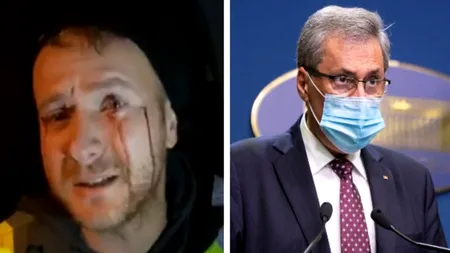 VIDEO. Anchetă după ce un activist de mediu a fost atacat cu pietre și umplut de sânge de „mafia lemnului”. Reacția lui Marcel Vela
