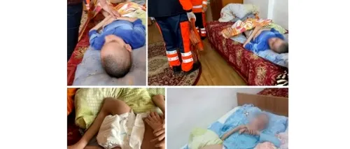 Caz șocant în Vâlcea. Georgiana, o tânără cu dizabilități, malnutrită, a fost ținută cu piciorul rupt timp de patru luni