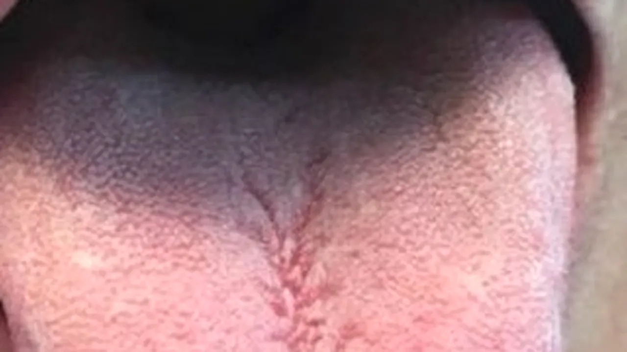 „Mi-au dispărut papilele gustative. Nu mai simt nimic