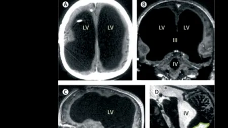 Descoperirea făcută de medici după ce un bărbat a ajuns la spital cu dureri de picior 