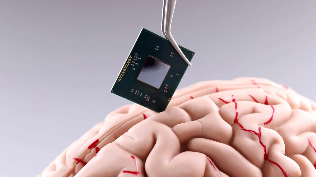 Vești extraordinare pentru persoanele care suferă de paralizie. Primul implant al unui cip neuronal a fost implantat în creierul uman