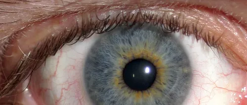 Cum sunt afectați ochii de privitul la calculator 