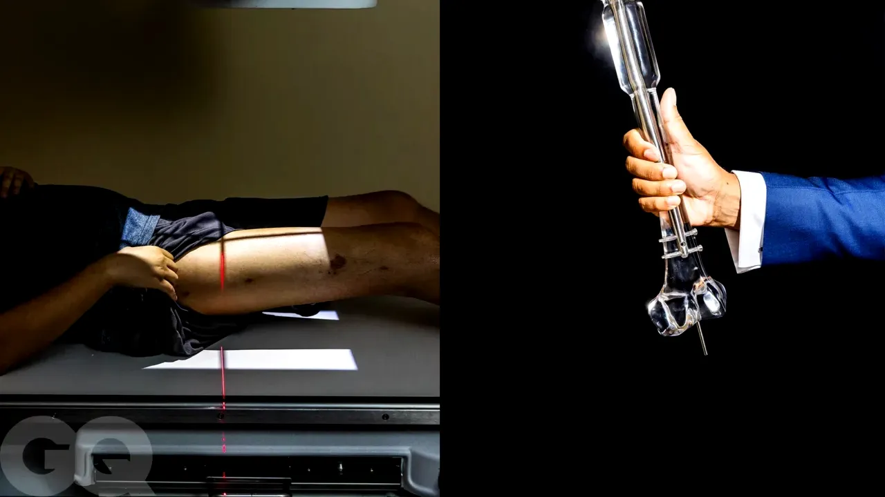 Bărbații scunzi, primii la ușa chirurgilor! Metoda de a crește până la 15 centimetri în înălțime