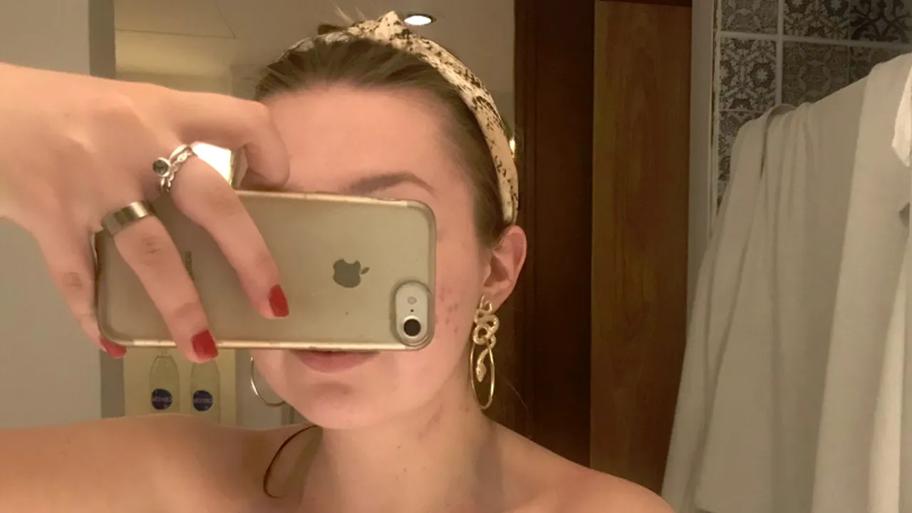 S-a dus la plajă și după doar 10 minute totul s-a transformat într-un coșmar. Costumul de baie i-a jucat o festă: E o glumă proastă? - FOTO