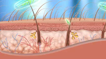 Ce este foliculita și cum putem scăpa de ea