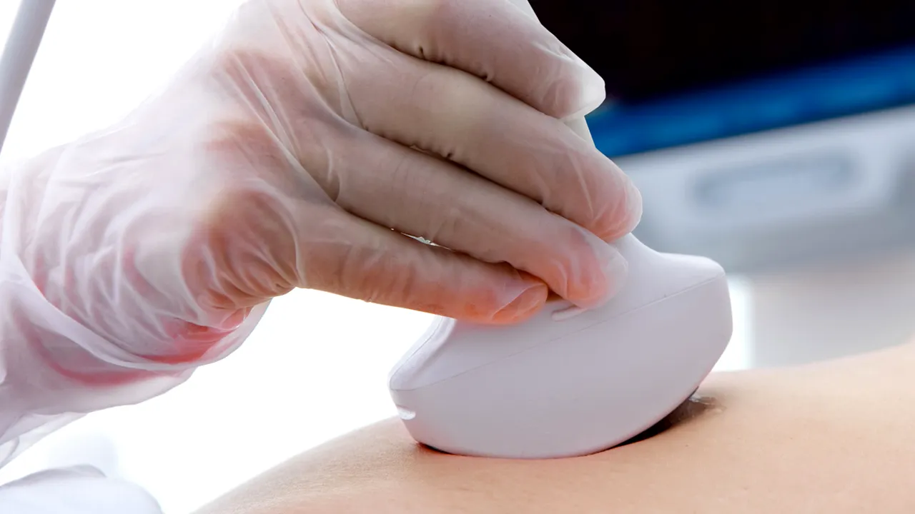 Ce este sindromul ovarelor polichistice și de ce apare