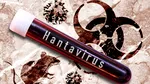 Reacția OMS după focarul de hantavirus care a ucis 3 persoane pe o navă de croazieră în Atlantic: „Nu indică o nouă pandemie. Riscul e scăzut”