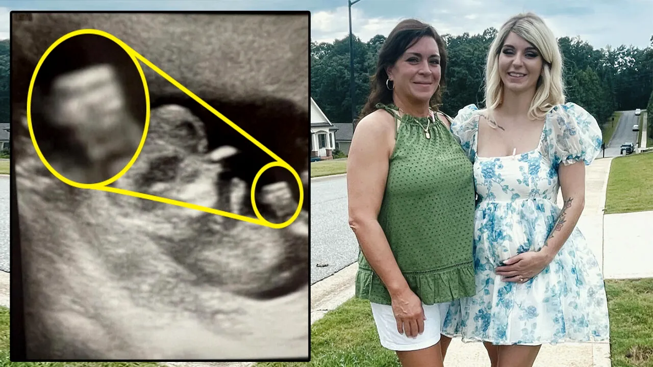 Această femeie gravidă a rămas mască după ce a făcut o ecografie. Detaliul BULVERSANT observat în această imagine