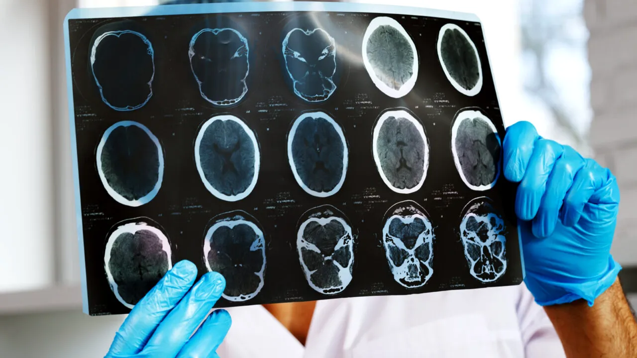 Neurologii vorbesc despre cel mai bun obicei pentru menținerea unei memorii bune după vârsta de 55 de ani. Ce ar trebui să faci zilnic