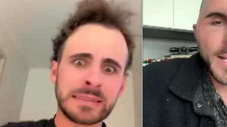 A plătit peste 17.000 de dolari pentru un implant de păr, dar rezultatul a fost total neașteptat. Ce a pățit acest tânăr după operație