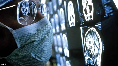 Ce indică pierderile de memorie la persoanele cu educație superioară