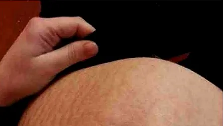 FOTO. Surpriza neașteptată pe care a avut-o o femeie însărcinată