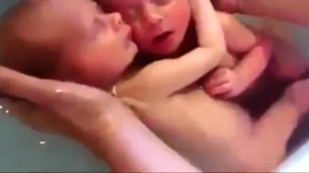 Gemenii care au uimit internetul. Cum au reacționat imediat după naștere