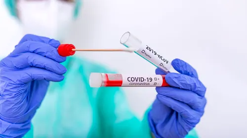 Bilanț coronavirus 20 decembrie: Puțin peste 400 de cazuri noi și 36 de decese, în 24 de ore. Sunt cele mai mici cifre din ultimele luni