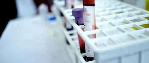 Premieră mondială. Cercetătorii clujeni au creat sânge artificial și sânge incolor