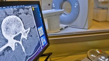 STUDIU. Ce efecte au în timp analizele de tip RMN efectuate în copilărie