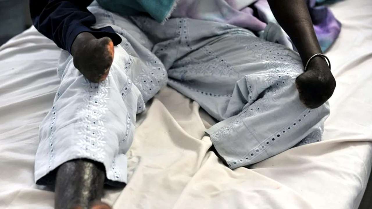 Lepra face anual mii de victime în Africa