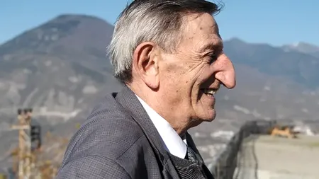 A murit bărbatul cu CEL MAI MARE NAS din lume! S-a stins din viață la vârsta de 75 de ani