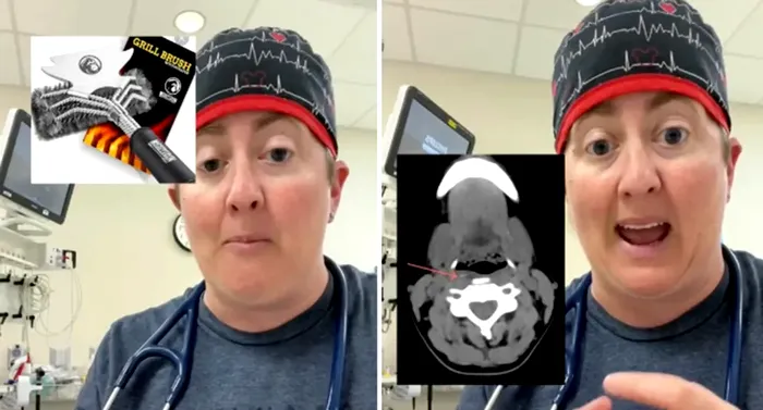 Copil ajuns la spital după ce a mâncat carne la grătar / Sursa foto: colaj capturi foto TikTok