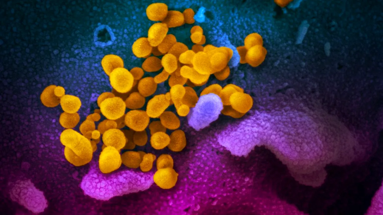 Primele imagini! Cum arată noul coronavirus la microscop
