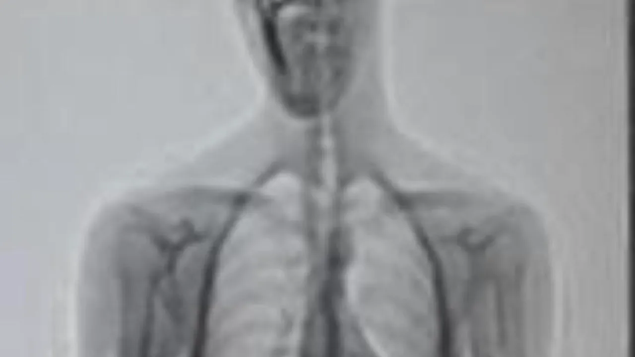 FOTO. Ce au descoperit polițiștii în stomacul unui deținut