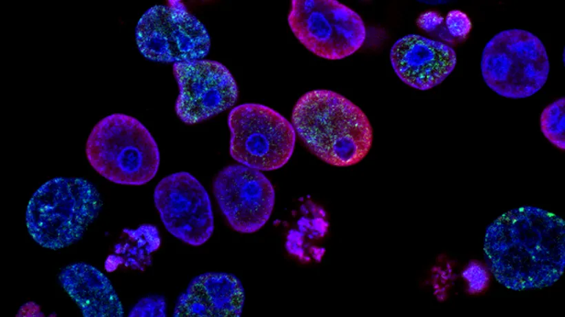 Primele celule artificiale care ar putea lupta împotriva cancerului. Sunt o alternativă promițătoare la tratamentele obișnuite